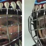 视频画面噪点太多难处理？试试这款高级视频降噪插件 轻松解决烦恼！